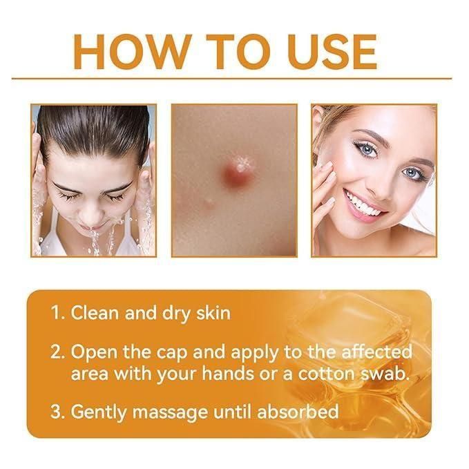 Bee Venom Skin Treatment Cream 100g (Pack of 2) mwa8y7-0i